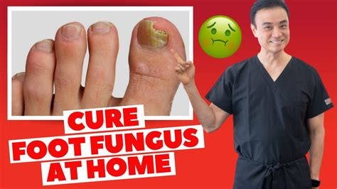 6 Effective HOME REMEDIES To CURE Toenail FUNGUS | Holistic Toenail ...