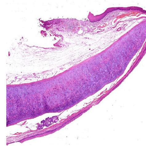 Glass Epiglottis Histology, Thickness: 1.2mm at Rs 500/piece in Noida | ID: 14795546155