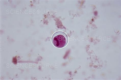 Photograph | Balantidium coli (LM) | Science Source Images