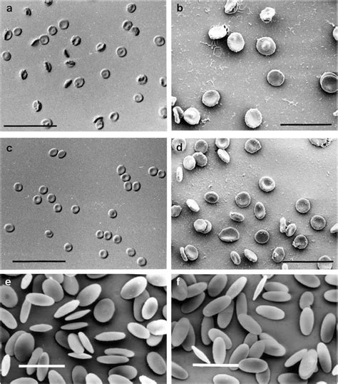 Red Blood Cell Electron Microscope