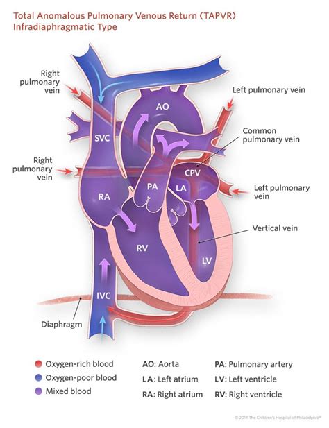 Tee Procedure Complications