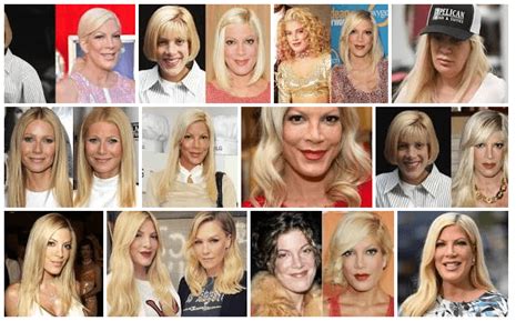 Tori Spelling Plastic Surgery Before And After (American Actress, Television Personality)