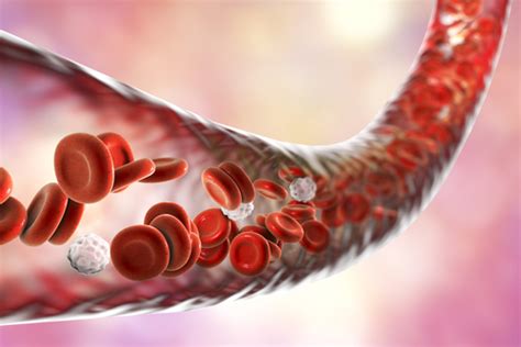 Antiphospholipid Antibodies Linked to Risk of Blood Clots in AAV Patients