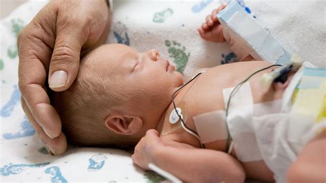 Premature birth & premature babies | Raising Children Network