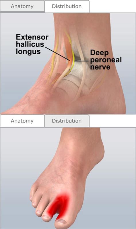 Nerve Blocks of the Lower Extremities - Procedures CONSULT JAPAN