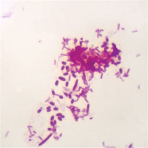 Amazon.com: Pseudomonas Aeruginosa, W.M. Microscope Slide : Electronics