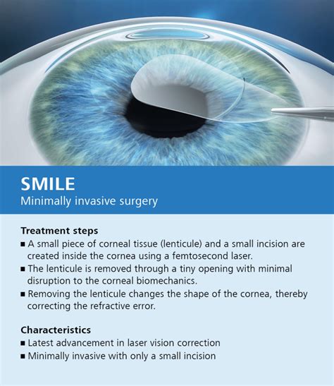 LASIK Beverly Hills | LASIK Eye Surgery Orange County | Gaster Eye