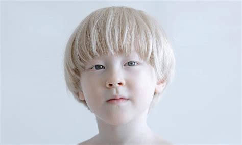 20 Stunning Portraits Showing Albinism's Beauty | Design & Photography - BabaMail