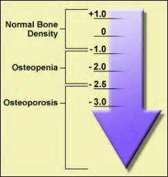 T-Scores - SHP - Tone Your Bones