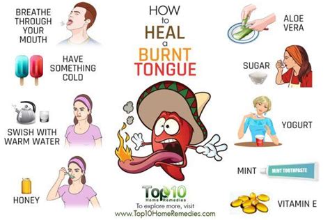 How to Heal a Burnt Tongue | Top 10 Home Remedies