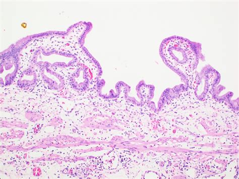 Gallbladder – Normal Histology – NUS Pathweb :: NUS Pathweb