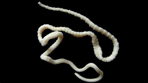 Mammoth 6ft live tapeworm removed from man’s gut through his mouth (GRAPHIC PHOTOS) — RT Viral