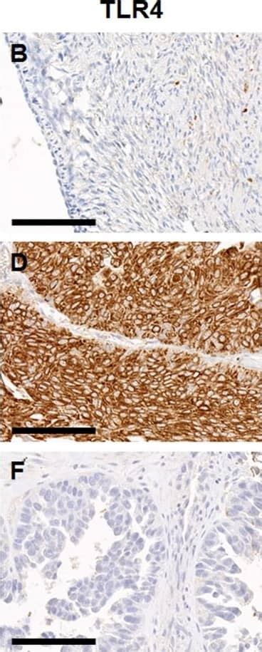 TLR4 Antibody (76B357.1) - BSA Free (NB100-56566) | Bio-Techne