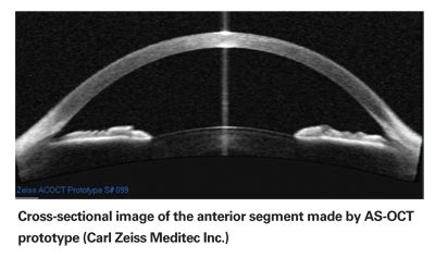 Anterior Segment OCT and Angle Closure