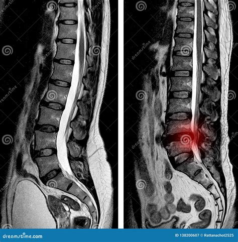 Mri scans for back pain | doctorvisit