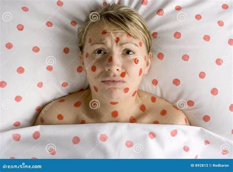 Woman with Red Spots on Face and Body Stock Image - Image of sickness, doctor: 892813