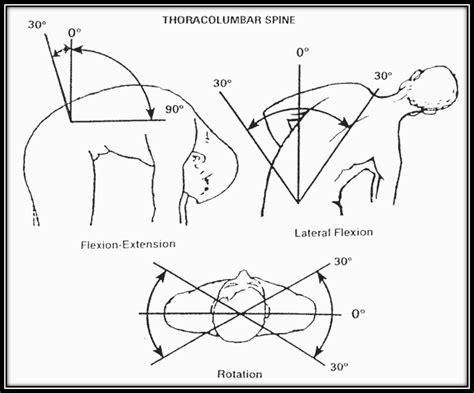 Secure a VA Disability Rating for Degenerative Disc Disease