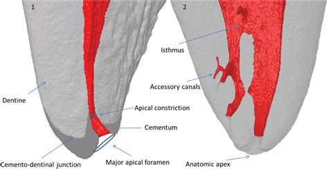 Apical Foramen