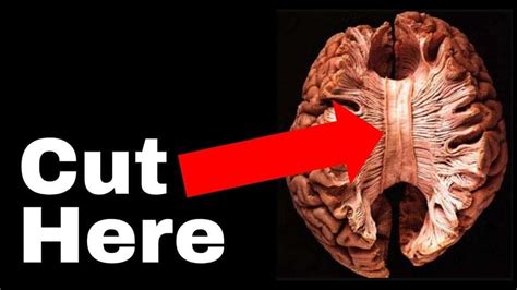 The Unsettling Truth about Human Consciousness | The Split Brain ...