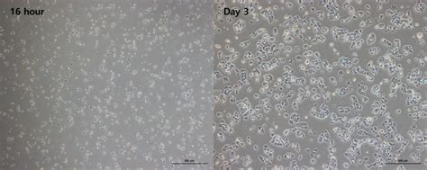 HepG2 cell culture morphology > BRIC