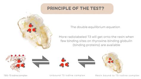 T3 Resin Uptake (T3RU) : A Detailed Guide - My Endo Consult