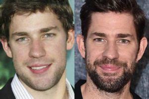 John Krasinski Plastic Surgery: Nose job and Facelift