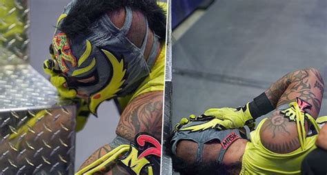 Rey Mysterio Eye Injury Video: How Did It Happen? Find His Photos Of ...