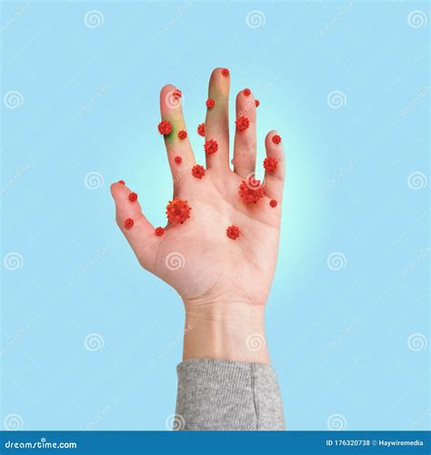 Virus Dirty Hand with Germs Stock Photo - Image of microscopic, concept ...