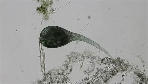 Stentor: Structure, Classification, and Characteristics – Microscope Clarity