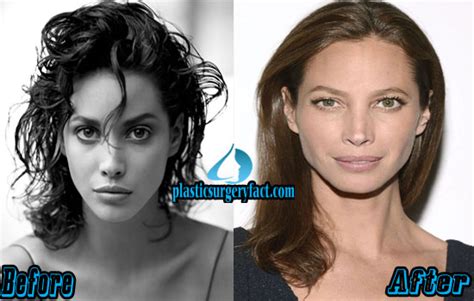 Christy Turlington Plastic Surgery Before and After Photos