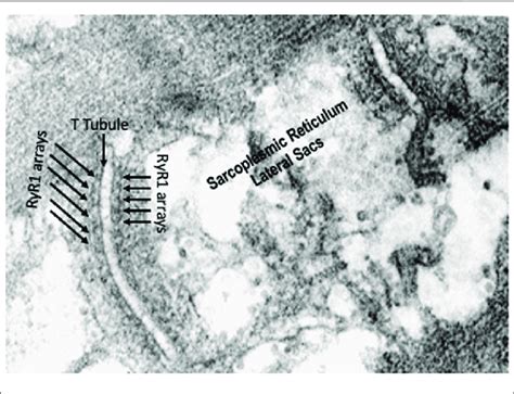 | High resolution electron micrograph showing the triads made up of... | Download Scientific Diagram