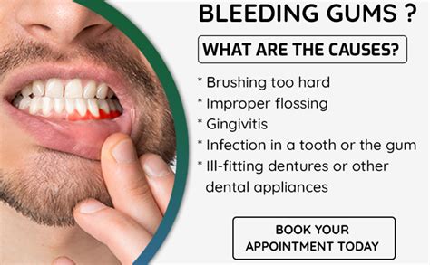 Gum Disease: Symptoms, Causes and Treatments – Adsorthodontics