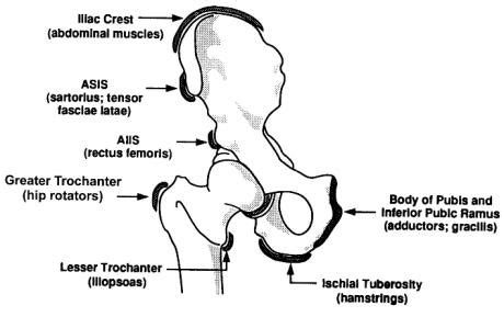 Anterior Superior Iliac Spine (ASIS) Avulsion - Knee & Sports ...