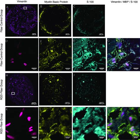 Immunohistochemical staining shows myelin basic protein (yellow ...