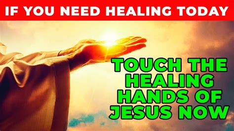 TOUCH JESUS HEALING HANDS TODAY FOR HEALING | Powerful Miracle Prayer ...