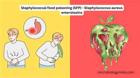 Staphylococcal Food Poisoning (SFP) Staphylococcus Aureus, 41% OFF