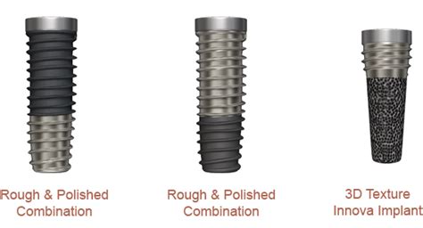 Dental Implant Types