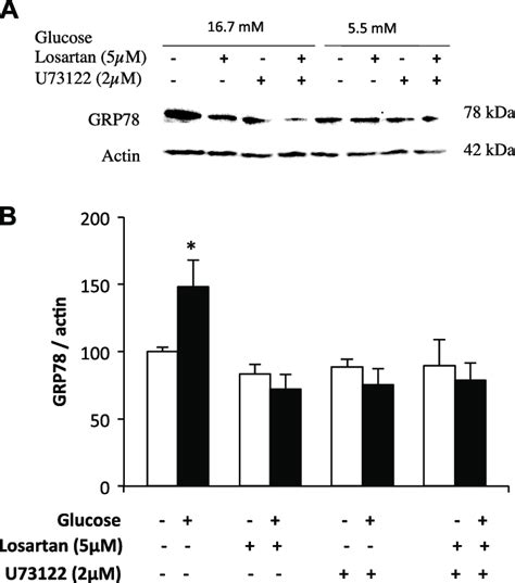 Quantitative analysis of GRP78 protein by Western blot. A) Western blot... | Download Scientific ...