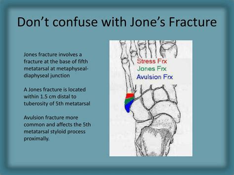 PPT - Radiology of Fracture Principles PowerPoint Presentation, free download - ID:1589986