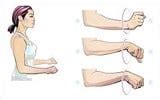 How to Treat a Sprained Wrist - Precision Movement