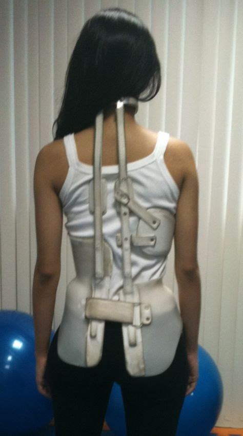 110 Scoliosis & braces ideas in 2021 | scoliosis brace, braces, scoliosis