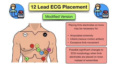 12 Lead ECG Placement: Diagram And Mnemonic For Limb And, 54% OFF