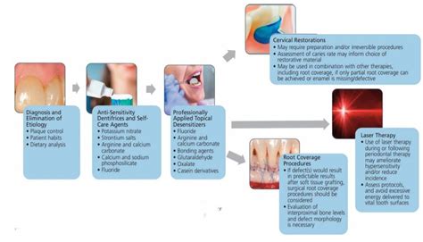 Dentin Hypersensitivity Treatment At Home - Captions Beautiful