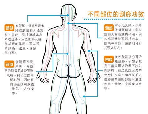 刮痧通經絡 非人人刮得 - 香港仔