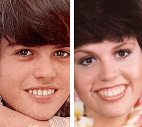 Marie Osmond No Makeup: Has the TV Star Ever Had Plastic Surgery?