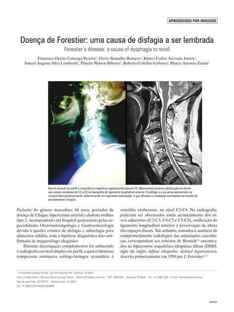 (PDF) Forestier's disease: a cause of dysphagia to recall