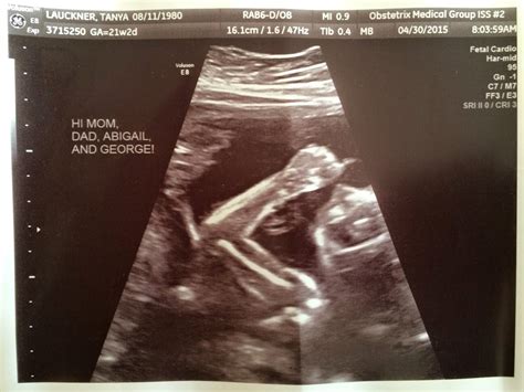 First Comes Love...: 20 week ultrasound