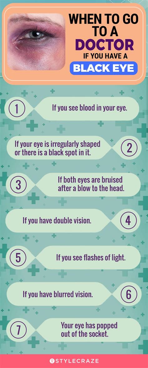 13 Home Remedies For Black Eye, Causes, And Prevention Tips