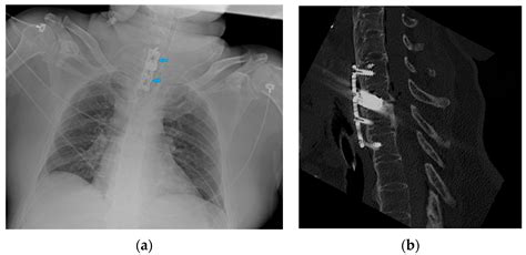 Diagnostics | Free Full-Text | Chest X-ray Interpretation: Detecting ...