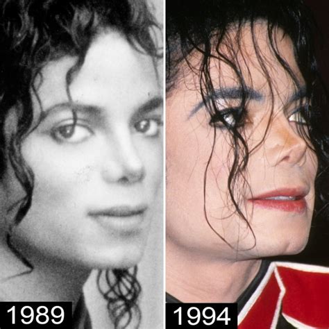 Michael Jackson's Plastic Surgery — See His Transformation